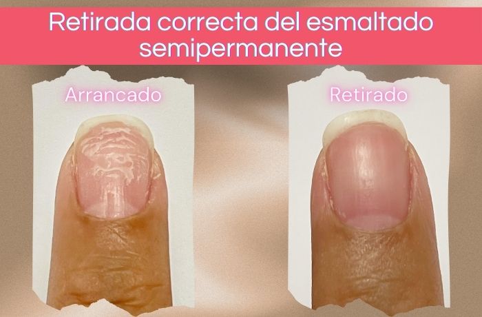 Foto de la comparación de un correcto retirado de esmaltado semipermanente y arrancar el esmaltado.